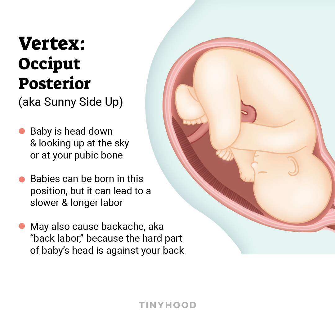 Baby sunny side deals up at 32 weeks